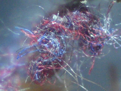 Morgellons fibers